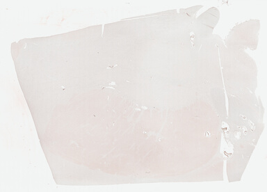 ['deident_4b2a2c10-9960-4ead-9053-f89e55097df0_69b03d36.jpg']