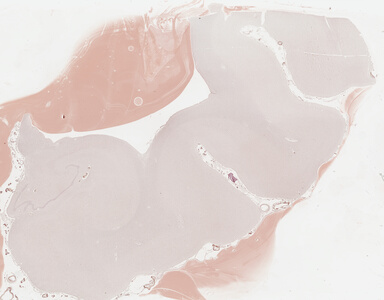 ['deident_ce47aa5e-b7e0-46a5-9ac5-6635673ad858_69b03d70.jpg']