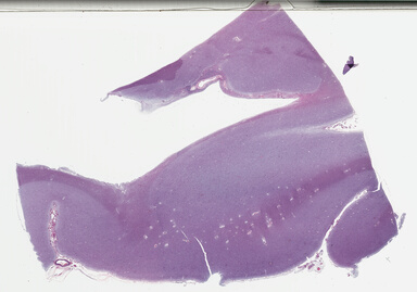 ['deident_2ec86c87-430a-47e5-b615-9bac2d5fbae6_69b03d23.jpg']