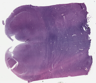 ['deident_e4790f99-d9db-4a75-aab0-5f78e1884e0b_69b03d78.jpg']