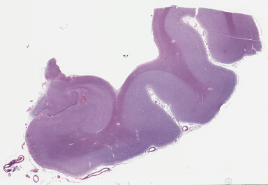 ['deident_1a98575f-b80d-4cfa-9cb0-8b43b7aab091_69b03d1d.jpg']