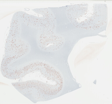 ['deident_eaaca4b3-d2ba-47d6-8584-d3b1a9f38c78_69b03d80.jpg']