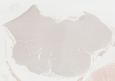 ['deident_6b9ea6df-743e-4bcf-8d21-874c9d9b351e_69b03d44.jpg']