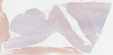 ['deident_3919fcab-f092-43b6-97b2-e0d24185ad64_69b03d30.jpg']