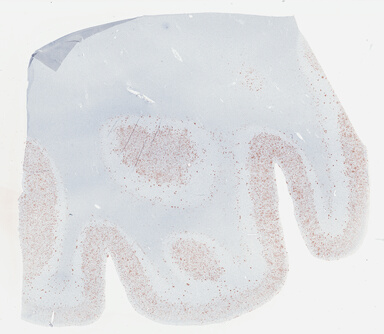 ['deident_b8e7ea8e-9b8f-49ff-8a8e-c2e23dfba4d5_69b03d65.jpg']