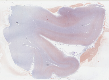 ['deident_c725cb76-2b36-4540-a5c9-569d03959c68_69b03d6c.jpg']
