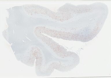 ['deident_04ad3ecc-16ab-4798-8429-ecf96ea388f9_69b03d0f.jpg']