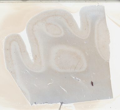 ['deident_e0c10823-1cf0-45e7-ad44-3ac4b863aae2_69b03d76.jpg']