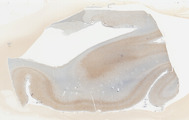 ['deident_6e5c5650-9c05-49a3-8ac0-e60c0f44e69e_69b03d46.jpg']