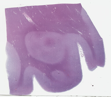 ['deident_8576a57f-d07e-41b1-917c-c9fbdb35ab65_69b03d50.jpg']