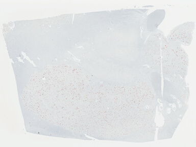 ['deident_415f594a-f184-41b4-9a82-b6e95d47c3b3_69b03d32.jpg']