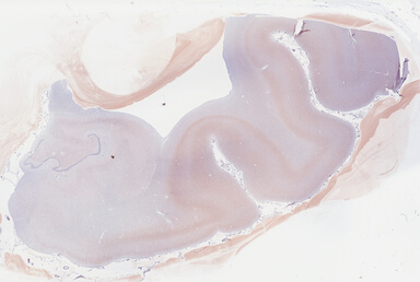 ['deident_2654cd3b-5db8-4c29-88cd-c13911709519_69b03d21.jpg']