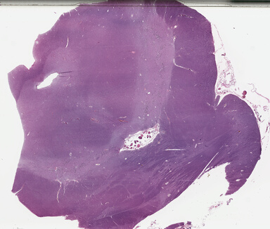 ['deident_58fe9219-974f-4fc2-892d-7e45fa053571_69b03d39.jpg']