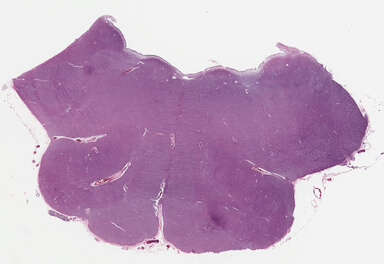 ['deident_6b674578-b96b-4bb9-af2c-b8695e4e8fbc_69b03d42.jpg']