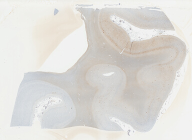['deident_0d3a5b5d-16b8-448d-988d-afa1a199eeb8_69b03d18.jpg']