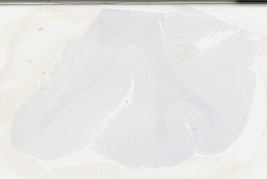 ['deident_986708ba-79ac-4946-af6b-edf62bb91f32_69b046c6.jpg']