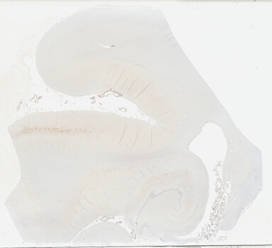 ['deident_c4db2e17-f27b-4840-b6aa-ce4a20c08622_69b046d4.jpg']