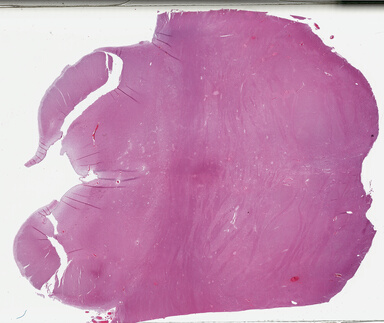 ['deident_ddc147b3-699e-4f77-aa1b-57623e798c39_69b046da.jpg']