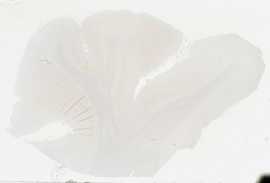 ['deident_34be1b9b-9b85-44d6-88fe-5146a11e9cf5_69b04694.jpg']