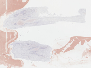 ['deident_57f25b30-0ac3-4f54-934e-886382c831bf_69b046a2.jpg']
