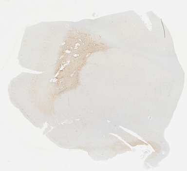 ['deident_b3290bae-e587-4e29-97da-3ee60b149e5e_69b046ca.jpg']