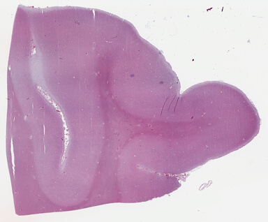 ['deident_e60bca50-26e3-4e7f-b3c2-b8f4c8e82789_69b046e0.jpg']