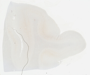 ['deident_cfcb4b2f-f7c2-4add-8257-8abb9b4e4559_69b046d7.jpg']