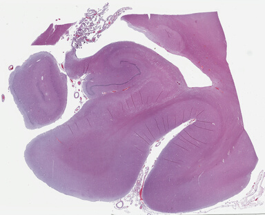 ['deident_6da6f4b6-8067-4820-95e3-e214aa833374_69b046b6.jpg']