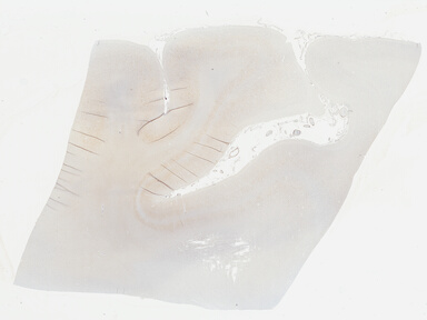 ['deident_af59501a-9838-4d7a-9c54-470ed9fde566_69b046c8.jpg']
