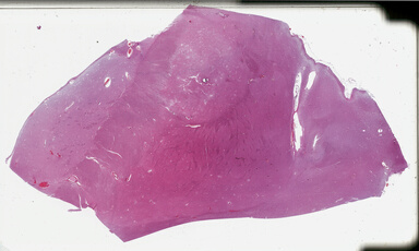 ['deident_b434f54c-1a2f-406c-b0d2-33bec126eb67_69b046cc.jpg']