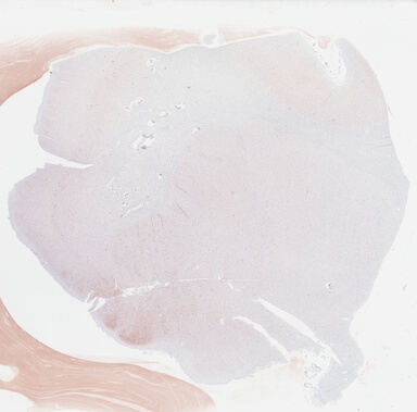 ['deident_be1a562a-04f2-4da3-8ab3-418287b66ae1_69b046d0.jpg']
