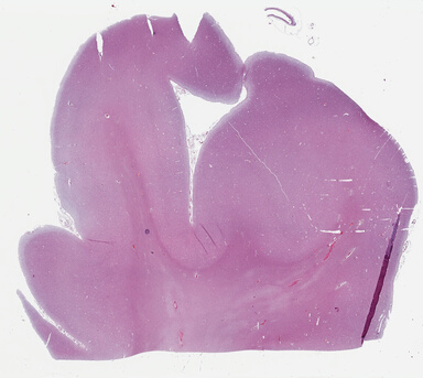 ['deident_d4b9d077-4df3-44b1-96bd-04e8535e12c8_69b046d9.jpg']