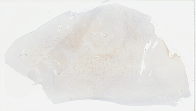 ['deident_66a4e21e-caab-44b2-83f1-7b18877cb01d_69b046ab.jpg']