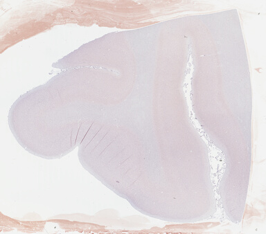 ['deident_60bb2e08-46b2-49f8-8ffc-e7a58ba71107_69b046a6.jpg']