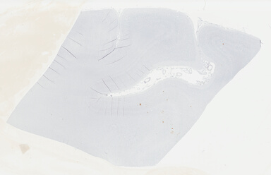 ['deident_3e447a8a-4147-48a9-b36a-1e63e2e4346f_69b0469e.jpg']