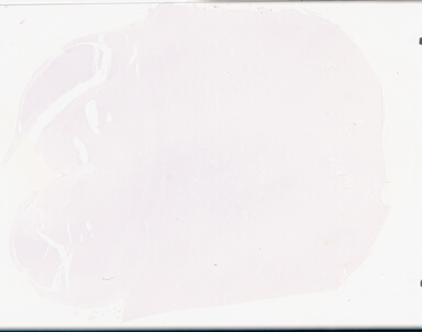 ['deident_6d7d238a-a002-4ff1-878a-e8f3bf73ddbb_69b046b5.jpg']