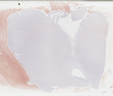 ['deident_f0f38684-55df-4d96-9ee6-41d748cce2ea_69b046e4.jpg']