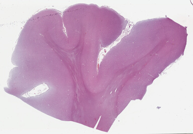 ['deident_77e765f4-ae9d-4ce6-a281-02255e270ec6_69b046b8.jpg']