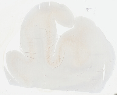 ['deident_2e62fb1a-13f3-4c02-9ad7-a00fc82a3fe0_69b04693.jpg']