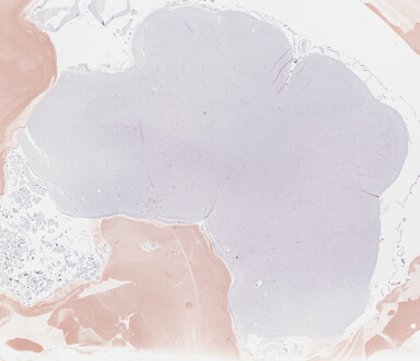 ['deident_edb807f8-915d-4e07-bdf0-1734e2fecd52_69b046e3.jpg']