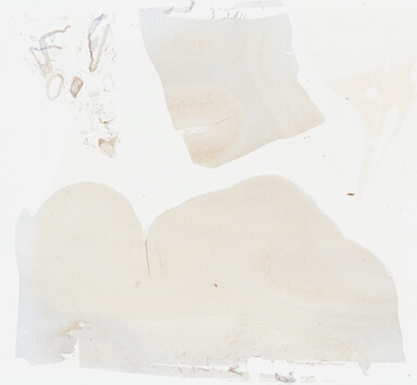 ['deident_0daa7365-9381-4589-b857-2ae1d848261b_69b04688.jpg']