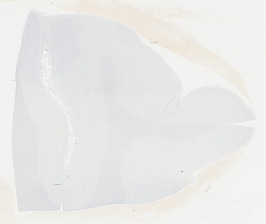 ['deident_c8e2b17a-9faf-4b06-b646-29ac0958bb5b_69b046d6.jpg']