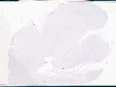 ['deident_0a18902f-ab92-4f05-beb2-029e4542fdad_69d94913.jpg']