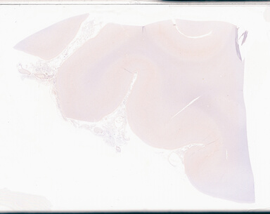 ['deident_82519640-66cb-4b41-96c5-3660a861cd05_69d9496d.jpg']