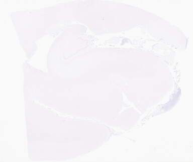 ['deident_be104274-9033-4b70-b093-44cc214b9d48_69d9498b.jpg']