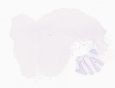 ['deident_16d0a249-cd18-4746-a1be-0b8d29d88d6a_69d94920.jpg']