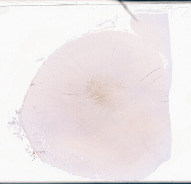 ['deident_fdc4f34b-9ff6-42c9-92e5-a6682f06d4a1_69d949aa.jpg']