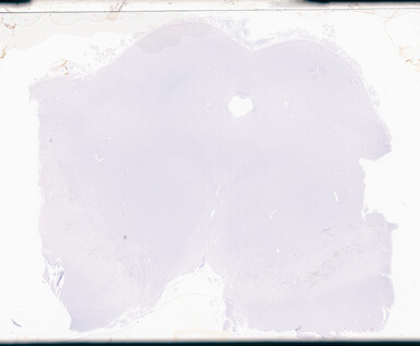 ['deident_16c38865-41a8-411d-806c-f71cd9272202_69d9491c.jpg']