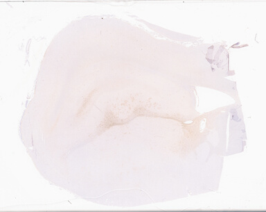 ['deident_136cbc92-9281-4812-a8a8-c732cc2695af_69d94918.jpg']