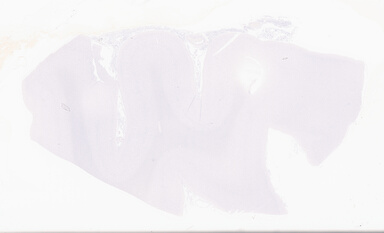 ['deident_ccefd01e-ef29-462b-962c-731ac2de5082_69d94996.jpg']